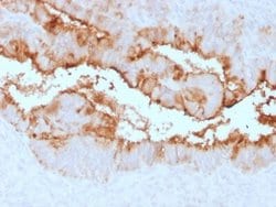 CA125/MUC16 Antibody (OCA125/2349R) - Azide and BSA Free, Novus Biologicals 100 &mu;g | Buy Online | Novus Biologicals | Fisher Scientific